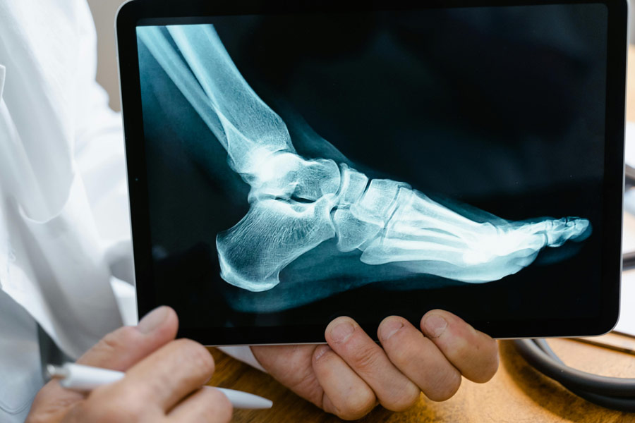 Doctor holding up image of an X-Ray