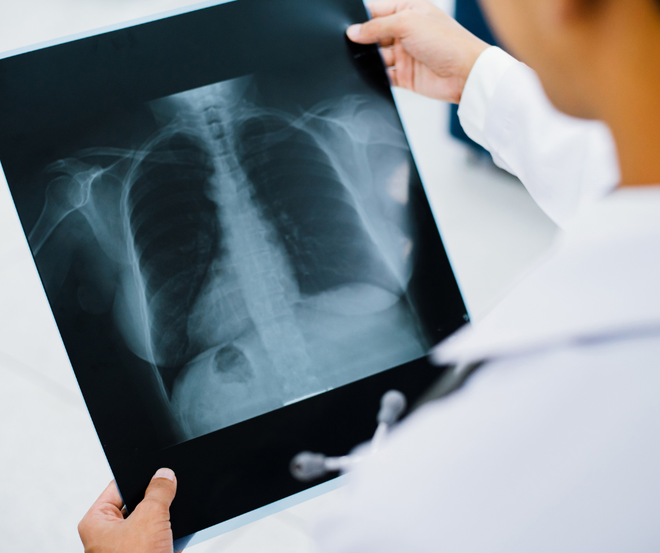 Understanding Different Imaging Modalities: MRI, CT, X-Ray, Ultrasound. What’s the Difference?