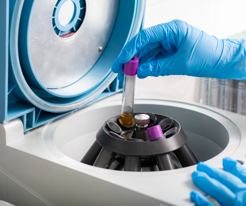 Platelet-Rich Plasma (PRP) Therapy: A Natural Approach to Healing Orthopedic Injuries